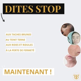 Vitamin C Serum – gegen braune Flecken – gleicht und hellt den Teint auf – strahlende und strahlende Haut – Der Effekt der Lampe Flash – 30 ml Belle après 40 ans