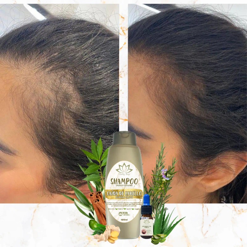 Tratamiento Ozonizado Anti-caída De Cabello Orgánico Romero