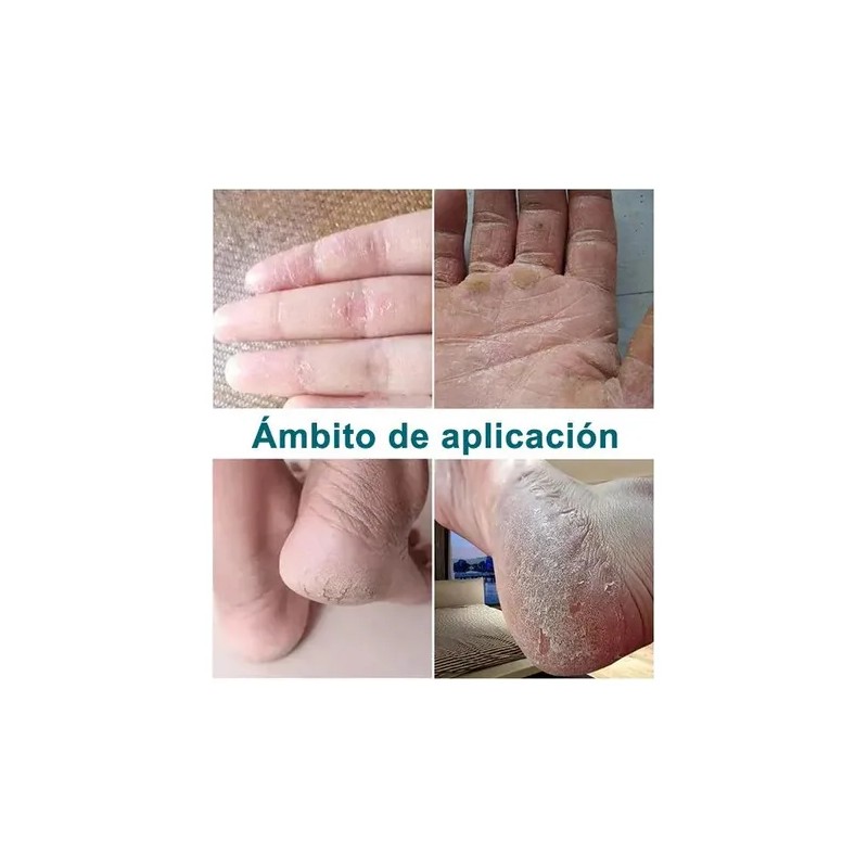 Artken Reparación Para Pies Agrietados Y Resecos - Crema R