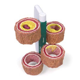GPI Anatomicals - 4-Piece Artery Model, Replica of an Artery with Plaque for Human Anatomy and Physiology Education, Anatomy Model for Doctor's Offices and Classrooms, Medical Learning Resources