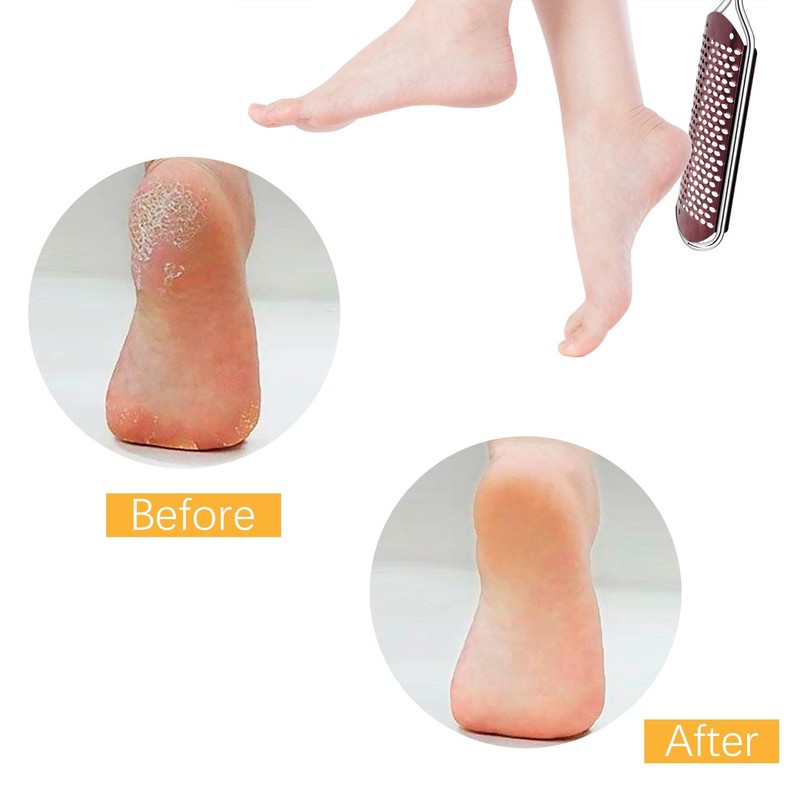 Pedicure Foot File Callus Remover - Large Foot Rasp Colossal