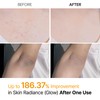 Dr.Melaxin Peel Shot Kojic Acid Turmeric Body Exfoliator Spray 6.76