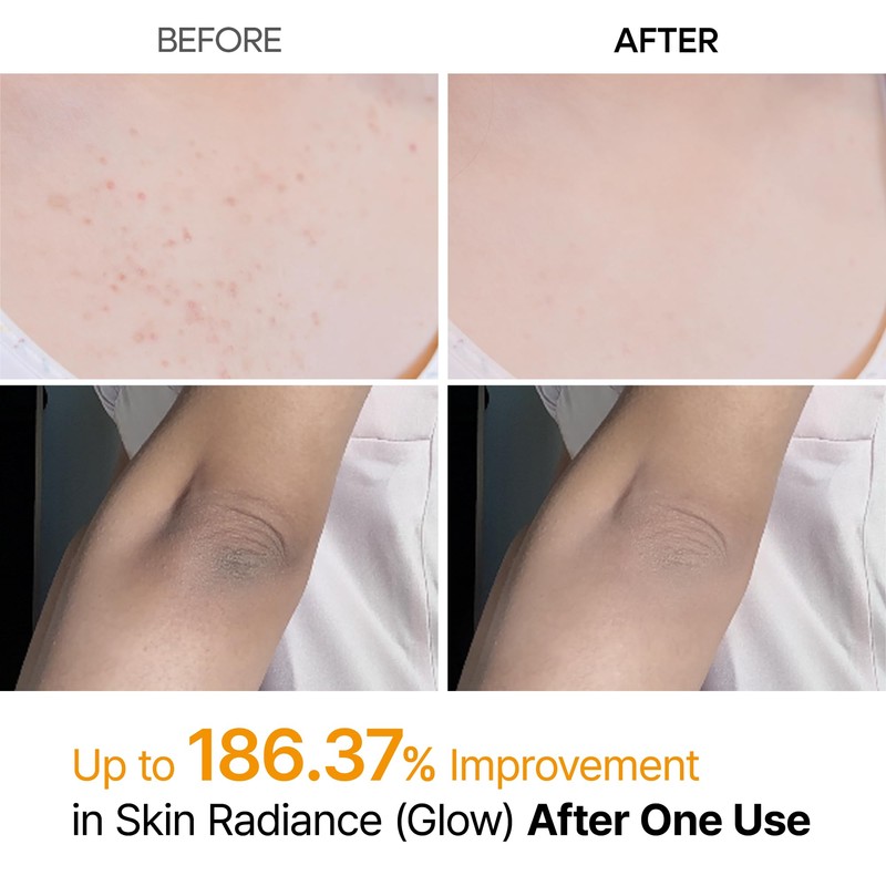 Dr.Melaxin Peel Shot Kojic Acid Turmeric Body Exfoliator Spray 6.76