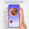 Ear Wax Removal Tool 10MP 6 LED Lights Smart Visual