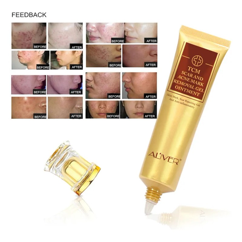 Gel Reparador Aliver Cicatrices Acné Queloides Mixta 30 mL Día