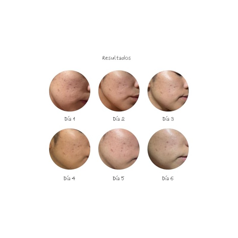 Sérum Facial Niacinamida, Pantenol y Ácido Hialurónico - Control de
