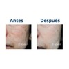 Suero Despigmentante Regulador 30ml Sérum Facial Aclarante Unificador Tono Piel
