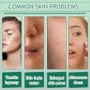 Set Cuidado Facial Aloe Vera Kit Limpiador Tónico Contorno Ojos