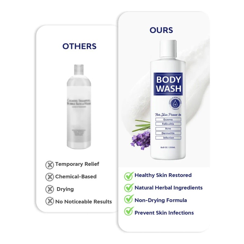 Gel De Baño Antifúngico Para El Acné Y El Eccema: