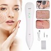 Mole Remover Pen 3 Gears Freckle Removal USB Rechargeable Skin