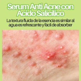 Suero Tratamiento Facial Contra Acné Ácido Salicílico 30ml F                                                                                          
