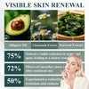 Luhaka Luhaka DermaEase Natureerase Instant Mole Spot Removal Gel,Purifying gel