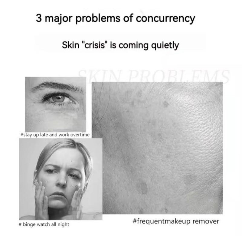 QINGLIN 【QINGLIN】Light Fine Lines Moisturizing Overnight Repair Anti-Wrinkle Essence Cream,