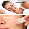 Large Pimple Patches for Face, 7 Sizes XL Acne Patches,
