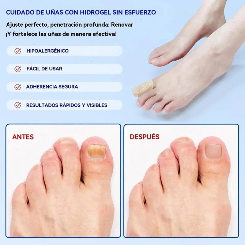 Ácido Salicílico Naíma 50g Cuidado Facial Mixta Exfoliante Antiacné Sin