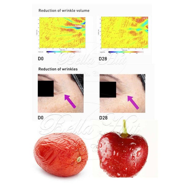 Lingon Berry Stem Cell~Photoaging Repairing~Glow Smooth Bright