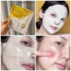 MediAnswer Vita Collagen Mask 37g x 10 Pcs Moisturizing K-Beauty