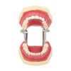 Periodontal Disease Teeth Resin Model Dental Demonstration Teeth Model for