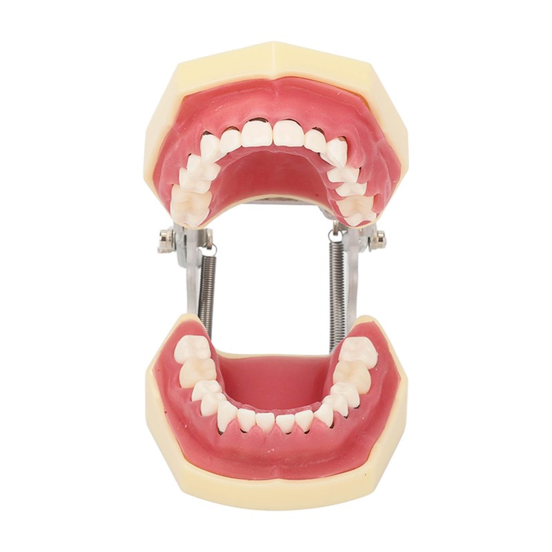 Periodontal Disease Teeth Resin Model Dental Demonstration Teeth Model for