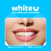 WhiteU Teeth Whitening Strips – 14 Strips – Peroxide-Free, Enamel-Safe,