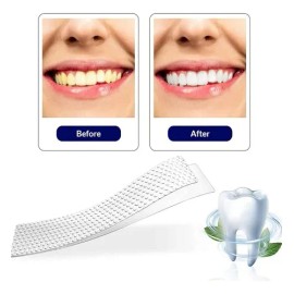 28 Tiras Blanqueadoras Dentales 5d White Higiene Bucal
