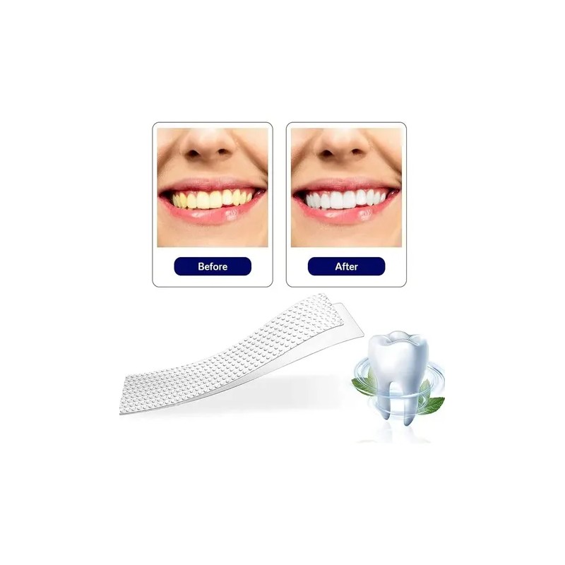 28 Tiras Blanqueadoras Dentales 5d White Higiene Bucal