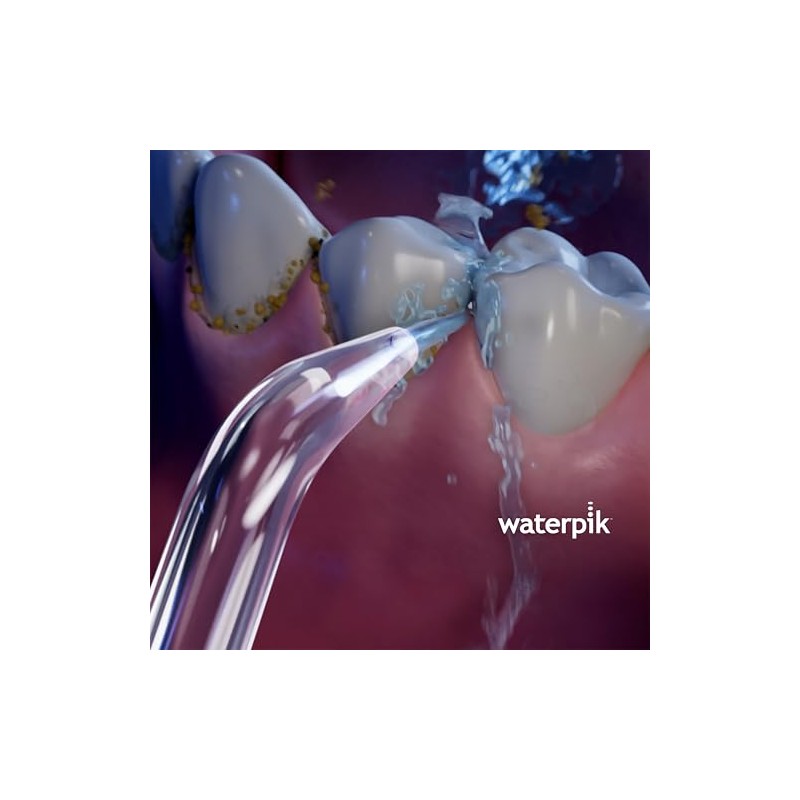Waterpik Classic High-Pressure Jet Tip, JT-450E (Pack of 2)