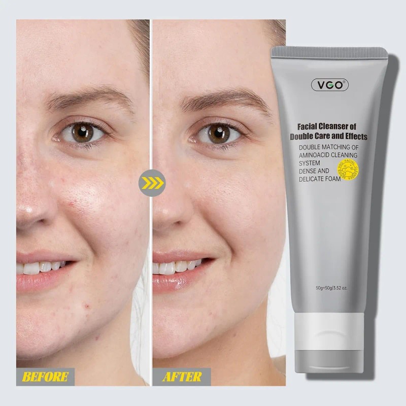 Limpiador Facial Vgo 2 En 1 Máscara De Barro Y