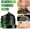 Kit de Mascarilla Eliminadora de Puntos Negros de Carbón Despegable