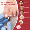 Ingrown Toenails, Nail Scissors, Toenails, for Nail Fungus Nail Clippers,
