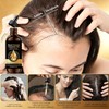 2pcs Conditioning Hair Aceite de Comino Negro 60ml, Aceite de