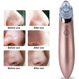 GPCT Electric Facial Pore Cleaner Blackhead Vacuum Suction Remover