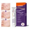 Zm T Gel Facial Antiacné Contiene Adapaleno For Piel Hy