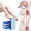 4 Pack Foot Pumice Stone, Double Sided Pumice Stone for