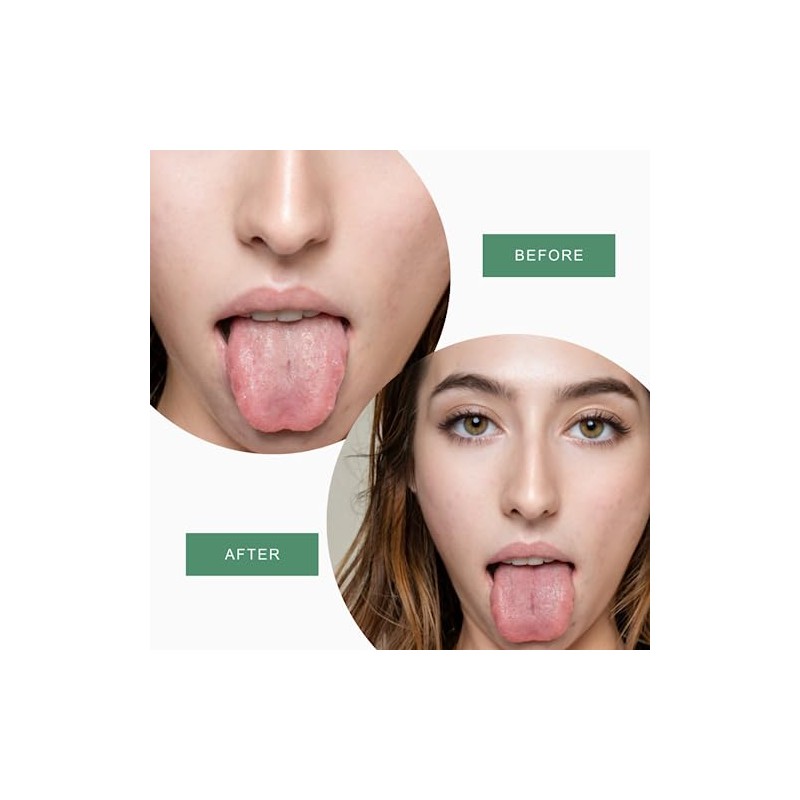 Rascador De Lengua De Acero Inoxidable Para Adultos Con Estuche