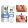 Crema Para El Cuidado De Las Uñas Para Morderse Las