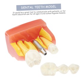 GLEAVI 1pc Teeth Model for Analysis and Oral Teaching Demonstration Model for Patient Education Structure Material
