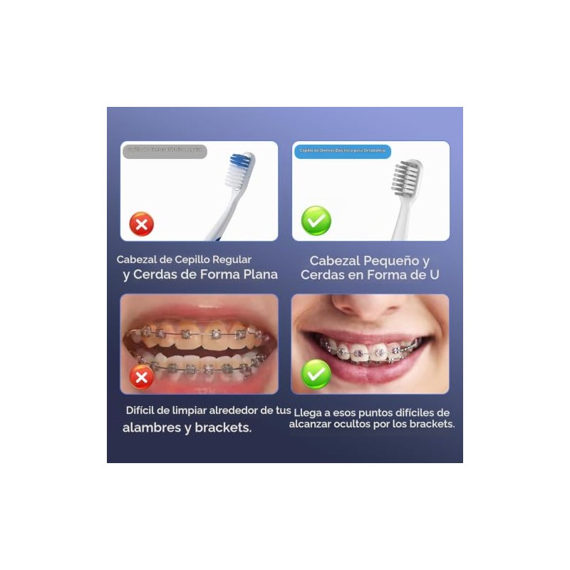 JTF Orthodontic Electric Toothbrush for Braces with 6 U-Shaped Brush