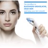 Senelux Blackhead Remover Vacuum Pore Cleaner Acne Comedone Extractor Face
