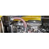 Hose Candy 309050005 Black Carbon Fiber Upper Radiator Hose Skin