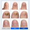 Tracen Kerasoft Nail and Toenail Nutrient Ampoule, 30ml, 2 Pieces