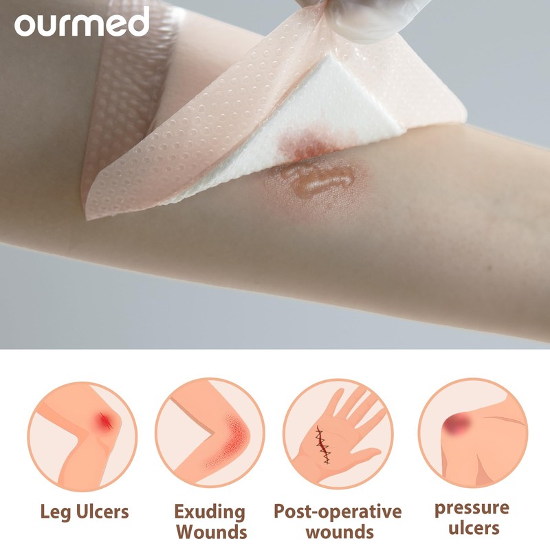 Ourmed Soft Flex Silicone Foam Dressings(6"x 6", Pack of 10)