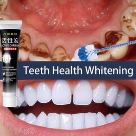 【🔥Special Offer】Activated carbon toothpaste 100g for removing tartar, removing yellow tartar, refreshing breath, whitening toothpaste, and cleaning the oral cavity