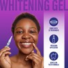 Premium Wired Teeth Whitening Kit – LED Light Teeth Whitening