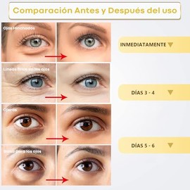 Parches para Ojos：60 Parches para Ojos Acido Hialuronico 24k-Colageno Parches Contorno de Ojo | Eliminar Bolsas y Ojeras | Patas Gallo e Hinchazón|Hid