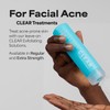 Paula's Choice CLEAR Regular Strength Anti-Redness Exfoliating Solution with 2%