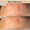Arroz + Miel: Mascarilla Exfoliante Hidratante 150ml Coreana Mixta