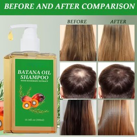 Batana Oil Shampoo,Batana Oil Hair Growth Shampoo,Repairs Damaged Hair for Denser Fuller Hairs,Promotes Hair Wellness,Organic Ba/tana O/il for Healthy Hair,Anti Hairs Loss,Eliminates Split Ends