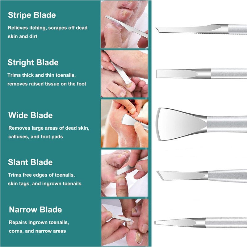 Pedicure Knife Ingrown Toenail Kit, 5 PCS Professional Pedicure Tool