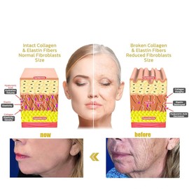 2PCS Bee Venom Wrinkle Removal Cream,Bee Venom Firming Serum,Advanced Firming & Wrinkle-Reducing Cream,Restore Skin Elasticity,Lifts, Plumps and Firms Skin, Reduces Wrinkles & Fine Lines